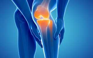 Что такое нестабильность колена и как ее лечить?