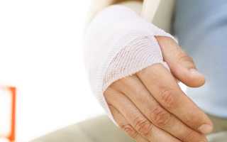 Признаки перелома кисти руки и способы лечения