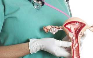 Современные методы удаления полипа матки и подготовка к ним
