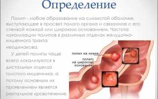 Отличие кисты от полипа и возможные осложнения после их появления