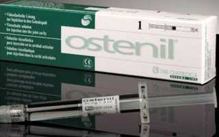 Остенил — эффективное средство при лечении болезней суставов