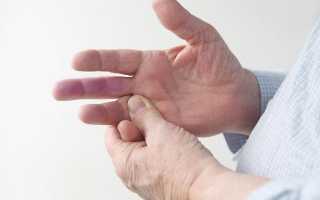 Почему возникает онемение среднего пальца на руке?