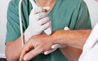 Как и для чего проводят УЗИ диагностику кисти руки?