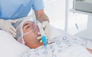 Сколько стоит седация при колоноскопии и как проходит диагностика под наркозом