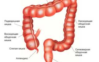 Что приводит к появлению полипов сигмовидной кишки и как от них избавиться