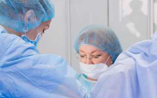 Порядок проведения Гистерорезектоскопии полипа и возможные осложнения