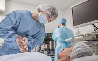 Как проходит послеоперационный период после гистероскопии (удаления полипов в матке)