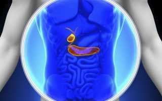 Главная опасность при полипе желчного пузыря и нужно ли его удалять