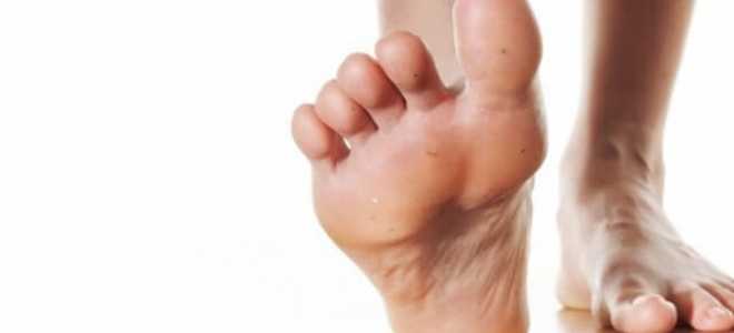 Почему может неметь стопа и как с этим бороться?