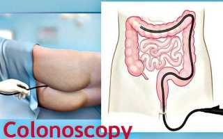 Чем заменить колоноскопию кишечника? 9 альтернативных методов диагностики