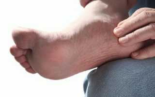 Причины болей в подъеме стопы и способы их устранения