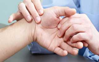 Причины и способы лечения ушиба кисти руки