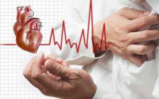 Аритмия и другие проблемы сердца при остеохондрозе