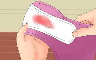 В чем опасность кровотечения полипа у беременной женщины