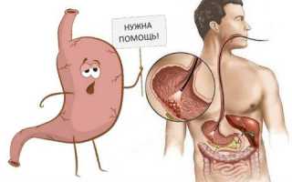 В чем опасность полипов в желудке и как их можно вылечить