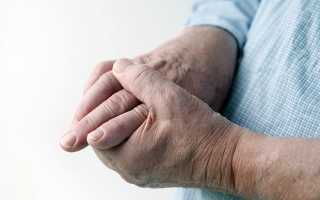 Признаки развития артроза кистей рук и его лечение