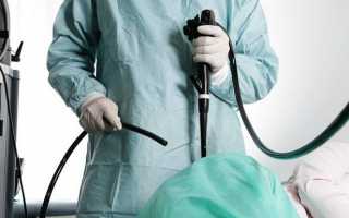 В каких случаях противопоказано проводить колоноскопию и есть ли риск в процедуре