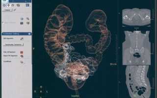 Порядок проведения виртуальной колоноскопии и её стоимость