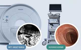 Лучше ли МРТ кишечника чем Колоноскопия и можно ли заменить процедуру