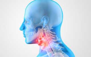 Виды кисты шейного отдела позвоночника и ее лечение