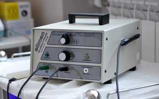 Этапы процедуры удаления геморроя аппаратом Сургитрон и отзывы пациентов