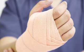 Лечение и восстановление при вывихе кисти руки