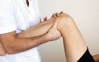 Как определить вывих колена и чем его лечить?
