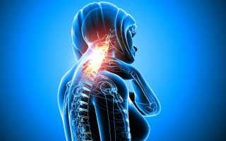 Как избавиться от боли в шее при остеохондрозе?