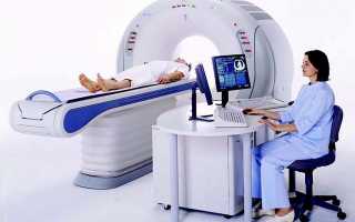 Какими способами диагностики можно проверить кишечник кроме колоноскопии?