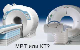 Чем отличается КТ от МРТ позвоночника и что лучше сделать?