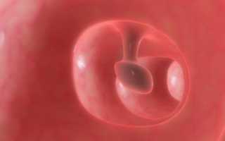 Какие последствия могут быть из-за полипов в уретре (мочеиспускательном канале)