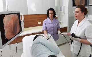 Как происходит процедура колоноскопия кишечника смотреть видео