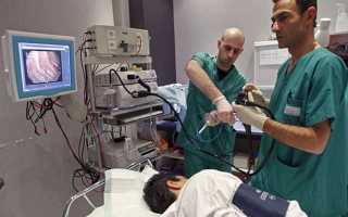 Сравнение колоноскопии кишечника и узи, какой метод исследования лучше?