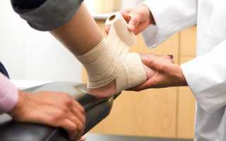 Признаки разрыва связок на ноге и особенности лечения