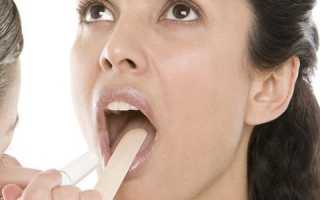 Что делать, если в горле обнаружили полип?