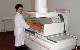 Чем отличается Колоноскопия от Ирригоскопии кишечника и что из них лучше