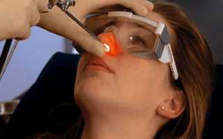 Лазерное удаление полипов в носу: цены, противопоказания и осложнения