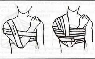 Для чего нужна повязка Вельпо и как ее накладывать?