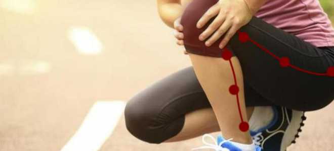 Что делать, если защемило нерв в коленном суставе?
