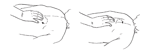 Массаж при сирингомиелии