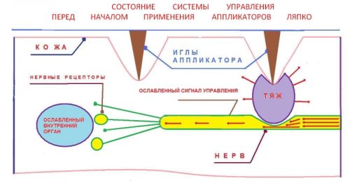 Механическое воздействие аппликатора Ляпко на нервы и органы Механическое воздействие аппликатора Ляпко на нервы и органы