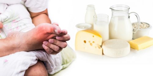 Какие молочные продукты разрешены при подагре?
