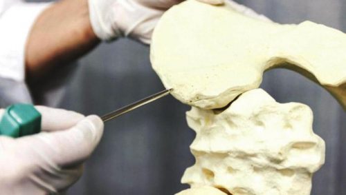 Смертельный мрамор кости Смертельный мрамор кости