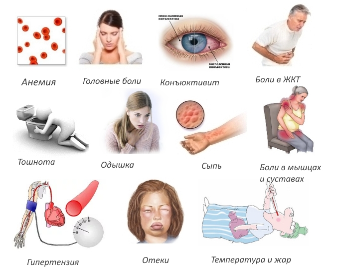 Побочные эффекты Золерикса Побочные эффекты Золерикса