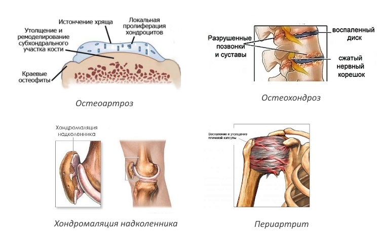 Показания для Протекона Показания для Протекона