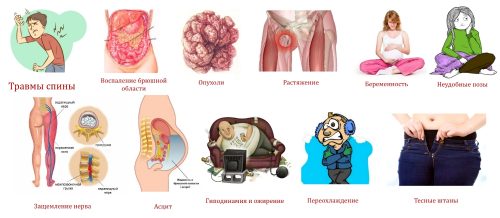 Причины болезни Рота