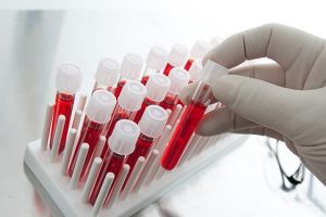 Анализ крови на уровень b12