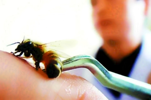 Апитерапия суставов Апитерапия суставов