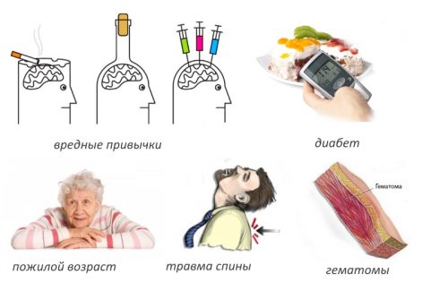 Факторы развития абсцесса