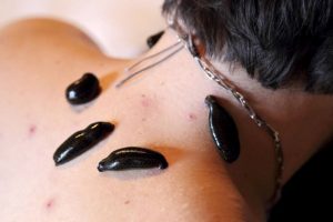 Гирудотерапия шейного отдела Гирудотерапия шейного отдела